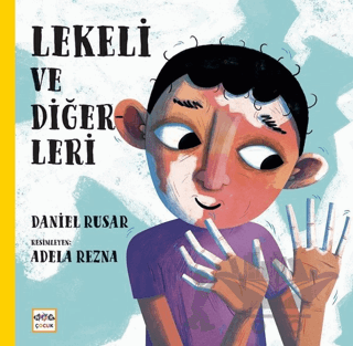 Lekeli ve Diğerleri