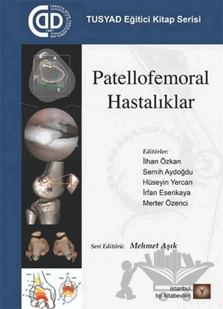 Patellofemoral Hastalıklar