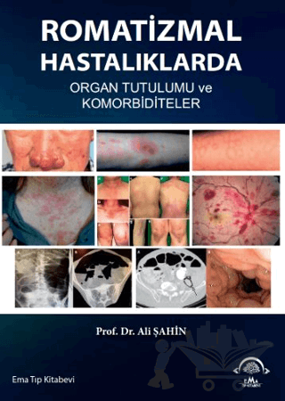 Romatizmal Hastalıklarda Organ Tutulumu ve Komorbiditeler